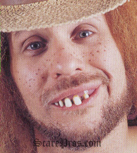 HillbillyTeeth.jpg