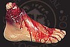 Bloody Foot